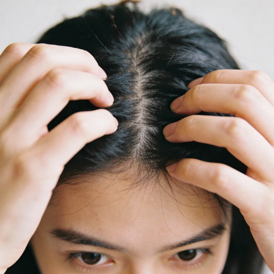 Scalp Allergic Reaction Help at Sussex