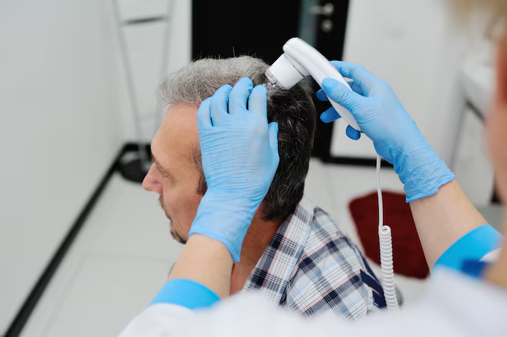 Male Pattern Baldness